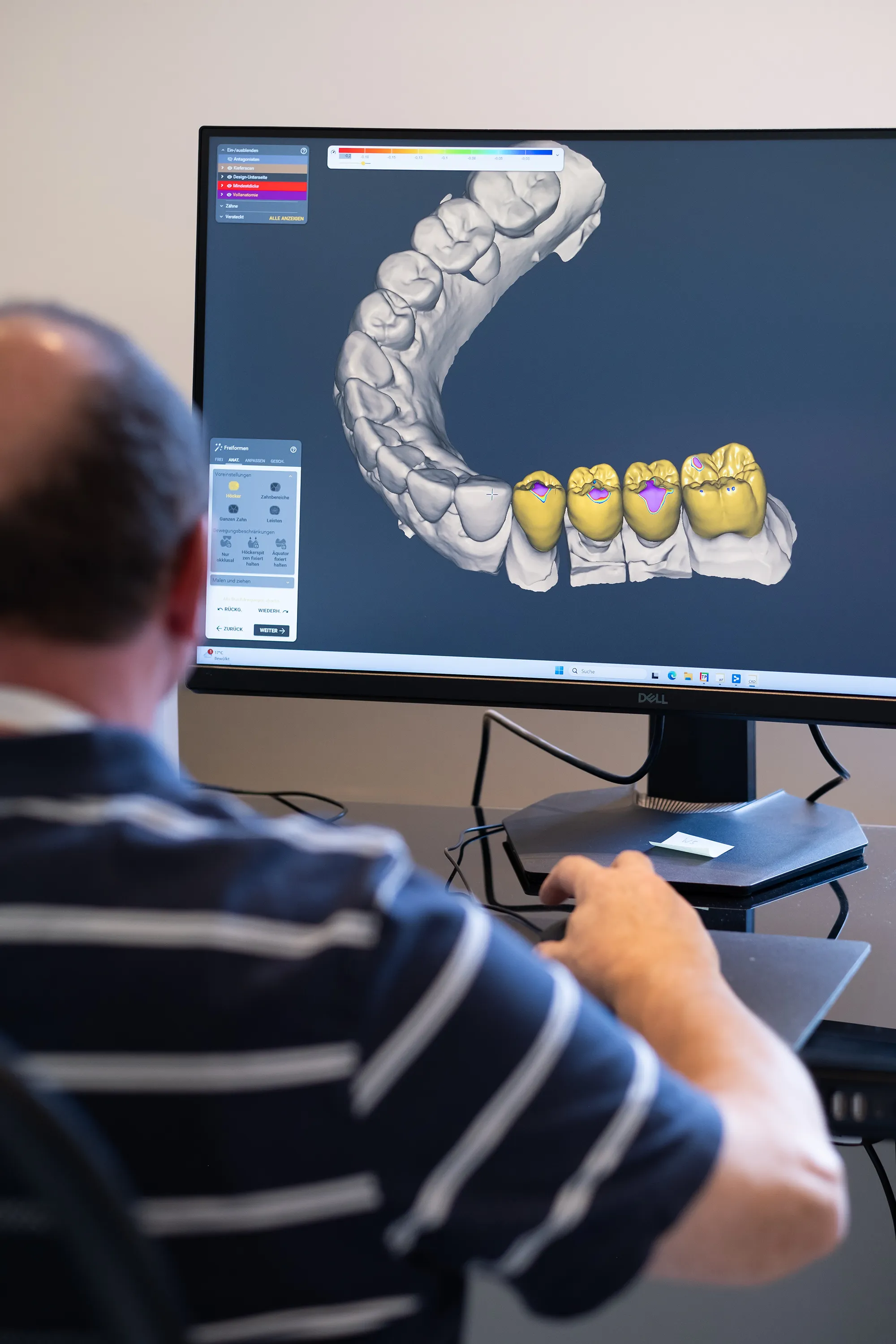 CAD/CAM-Konstruktion von Zahnersatz am Bildschirm im Eigenlabor der Werratalpraxis